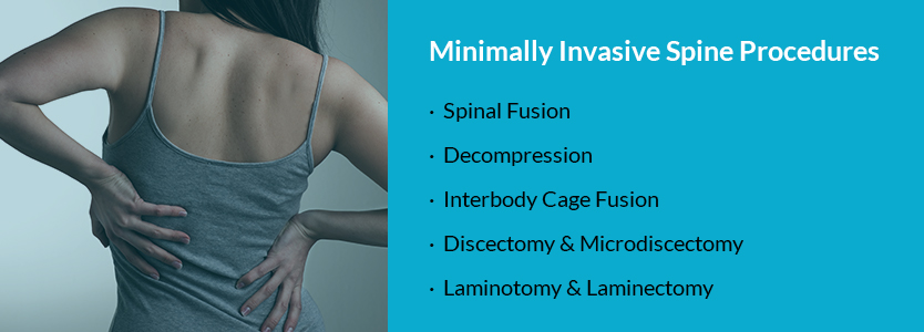 minimally invasive spine surgery procedures