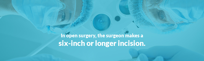 open surgery incisions
