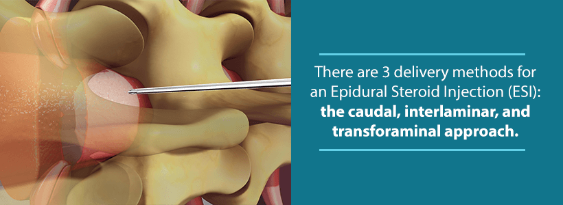 image of epidural steroid injection into spine