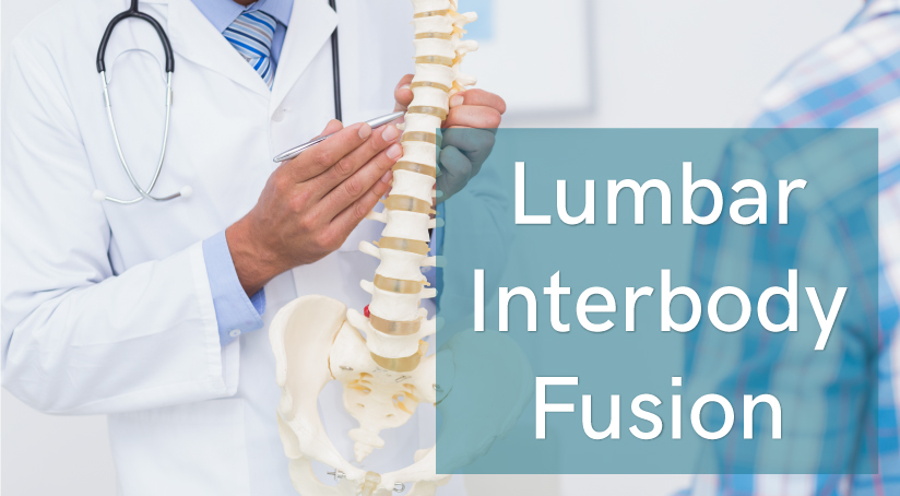 lumbar interbody fusion