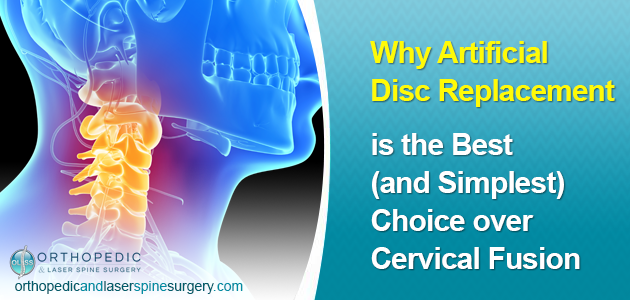 Why is Cervical Artificial Disk Replacement Better Than Cervical Fusion?