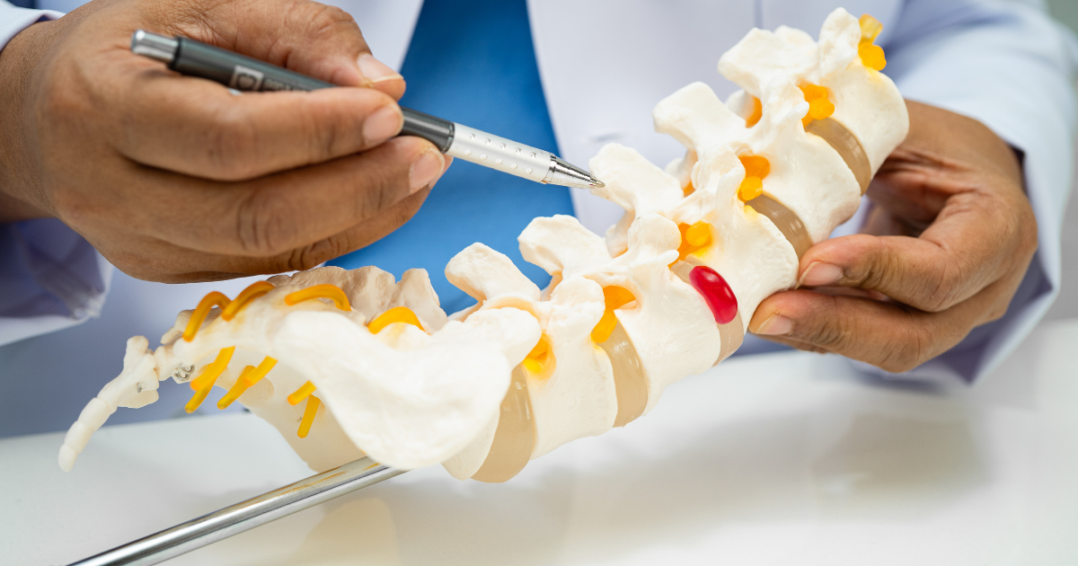 Doctor showing patient a herniated disc and a bulging disc to know the difference between spinal conditions
