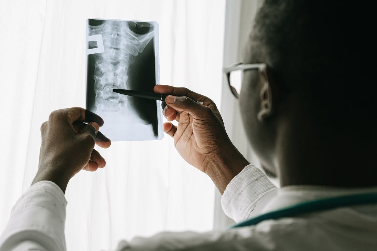 Spine and Spinal Cord