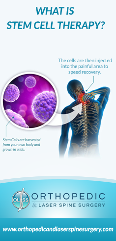 Stem Cell Therapy is available in #Florida and can help treat and relieve neck and back pain with out surgery! #neckpain #backpain 