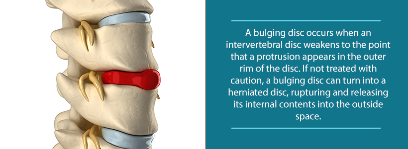 spine with bulging disc