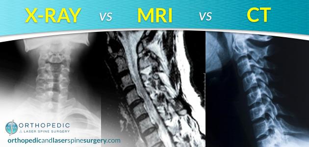 Difference Between X-Rays, MRIs, and CT Scans