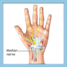 Illustration highlighting the anatomy of the median nerve in the left hand, showing its path and structure