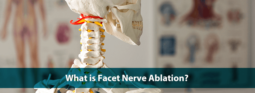 spine model with facet joints