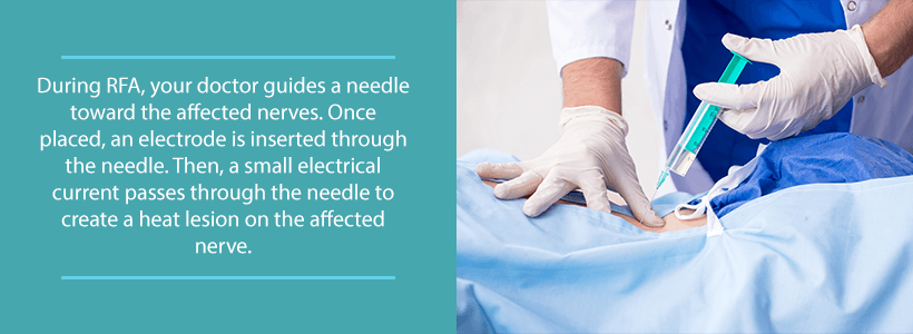 facet nerve ablation procedure in process