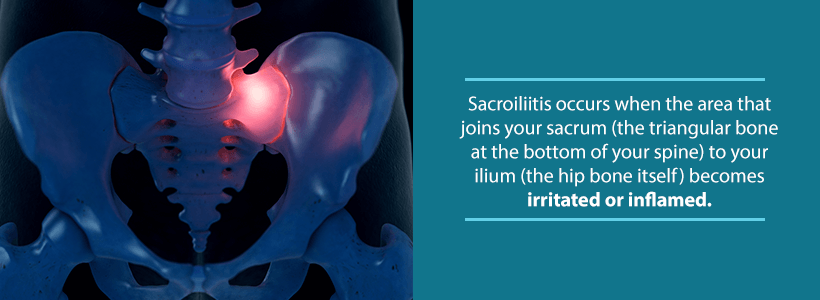 sacroiliac joint