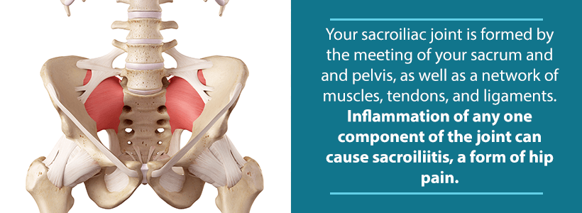 medically accurate image of sacroiliac joint and pelvis