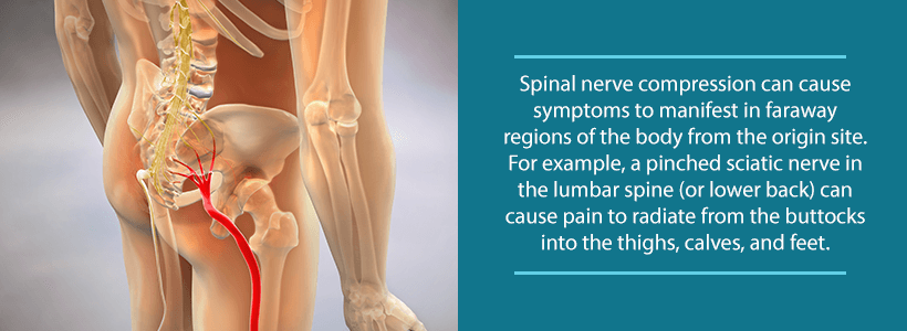 sciatic nerve compression