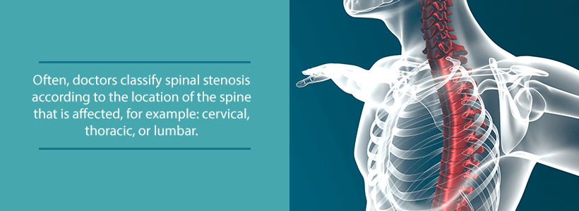 regions of spine affected by spinal stenosis