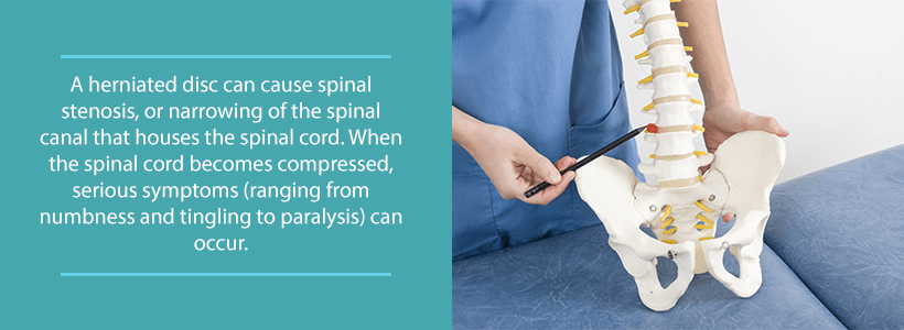 spinal stenosis from lumbar herniated disc